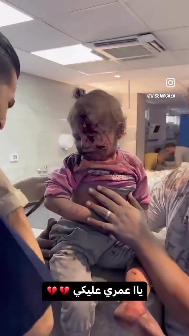 Palestine-Arab-Muslim Child After Being Bombed - Oct 18-2023