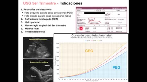 TERCER TRIMESTRE EMBARAZO