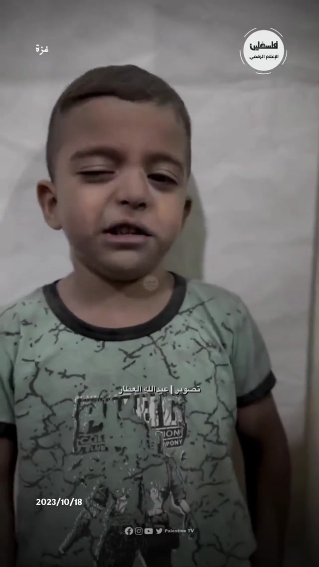 Little Palestine Baby Boy Survived IDF -Al-Ahli (Al-Ma’madani) hospital-Oct 18-2023 massacre.