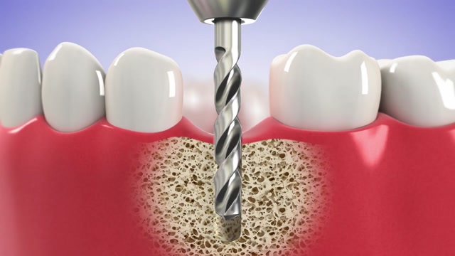 Guelph Dentist | Guelph Royal Dental Centre | Trusted Dentist