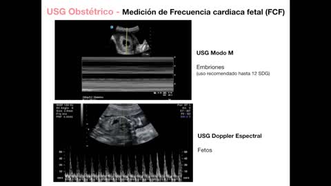 PRIMER TRIMESTRE EMBARAZO