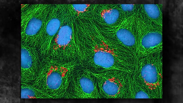 Henrietta Lacks (Ep. 4)