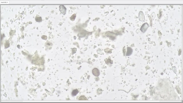 namexyz_after38_5-04-03-2026-400x-MainAs